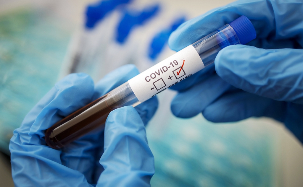 В России создан экспресс-тест на коронавирус